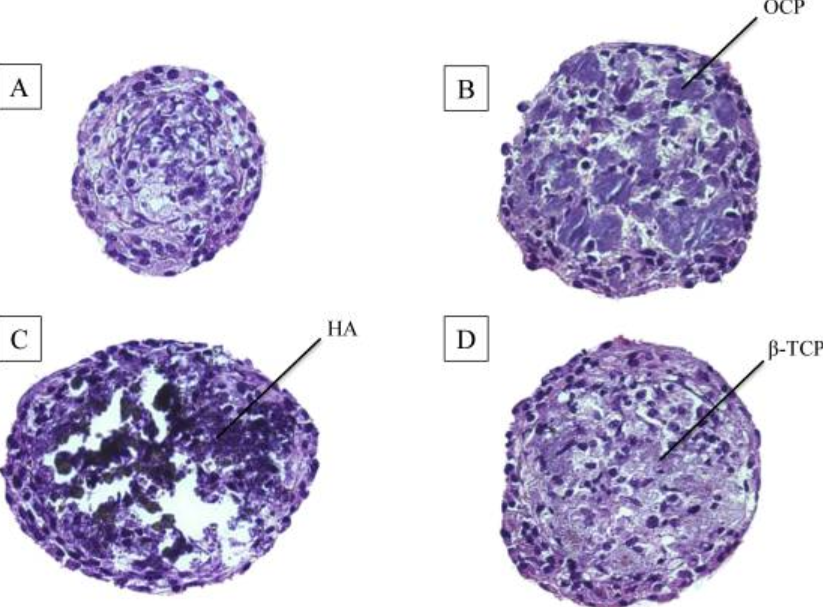 Fig. 4 H-E staining of (A) D1 cell spheroids, (B) OCP/cell spheroids, (C) HA/cell spheroids, and (D) β-TCP/cell spheroids after 7 days in culture. Mean diameter of OCP/cell, HA/cell, and β-TCP/cell spheroids in the medium was 294 μm, 297 μm, and 250 μm, respectively.