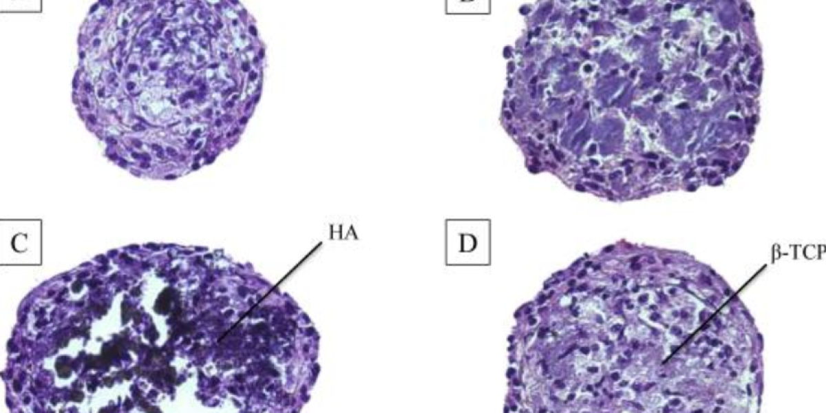 Fig. 4 H-E staining of (A) D1 cell spheroids, (B) OCP/cell spheroids, (C) HA/cell spheroids, and (D) β-TCP/cell spheroids after 7 days in culture. Mean diameter of OCP/cell, HA/cell, and β-TCP/cell spheroids in the medium was 294 μm, 297 μm, and 250 μm, respectively.